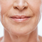 Labios (rojo o blanco) - TEOXANE Ácido Hialurónico 1ml - Imagen 2