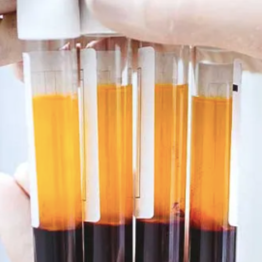 1 Mesoterapia con Plasma rico en plaquetas - Imagen 1