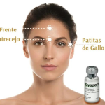 DYSPORT Toxina Botulínica 3 zonas - Imagen 2