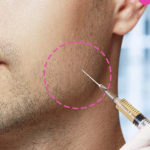 Bruxismo - Toxina Botulínica