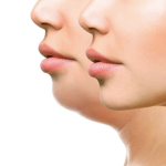 Lipopapada - Enzimas lipolíticas LIPOLAX - Imagen 2