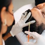 Mesoterapia con Plasma rico en plaquetas - Imagen 2