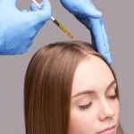 Mesoterapia con Plasma rico en plaquetas capilar 6 sesiones - Imagen 2