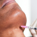 Lipopapada - Enzimas lipolíticas LIPOLAX - Imagen 3