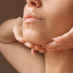 Mentón - TEOXANE Ácido Hialurónico