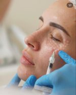 XELA REDERM 1.1% - Redermalización de ojeras