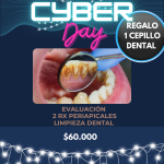CYBER - EVALUACIÓN + 2 RADIOGRAFÍAS+  LIMPIEZA DENTAL